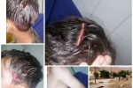 حمله سگ های بلاصاحب به کودک در مسجدسلیمان حادثه آفرید+ تصاویر
